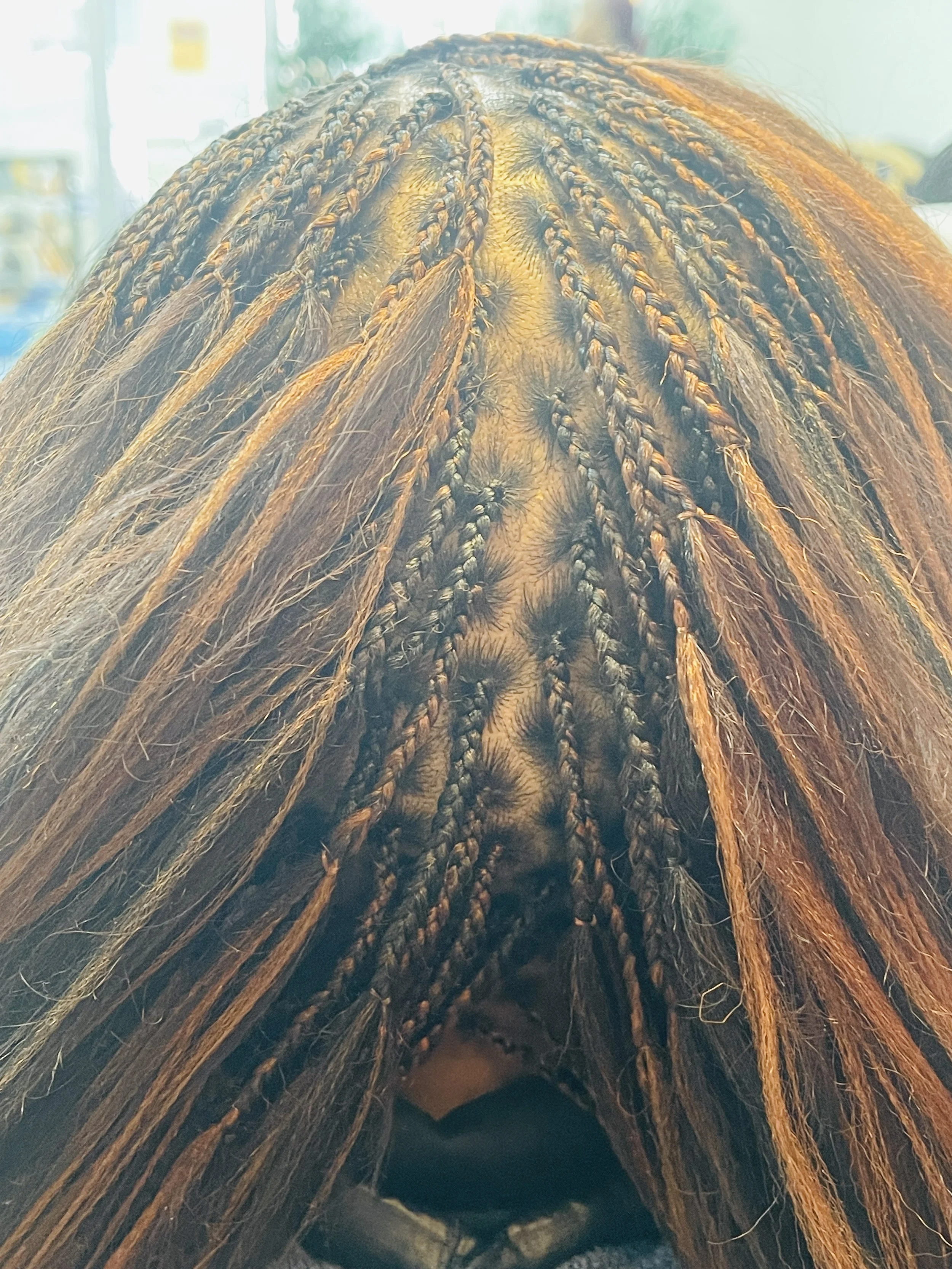 Close-up of the top of a person's head with braided hair, showing the scalp and braids in natural lighting.