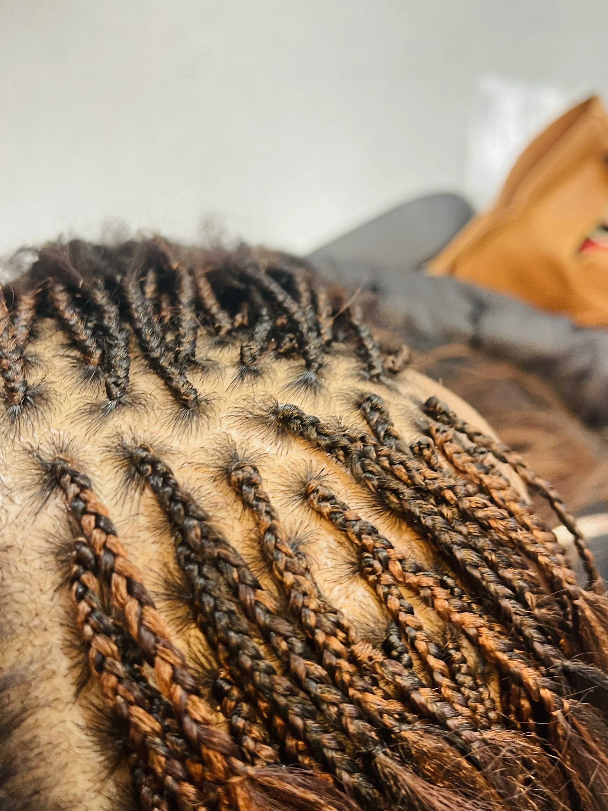 Close-up of a person's scalp with neatly braided hair.
