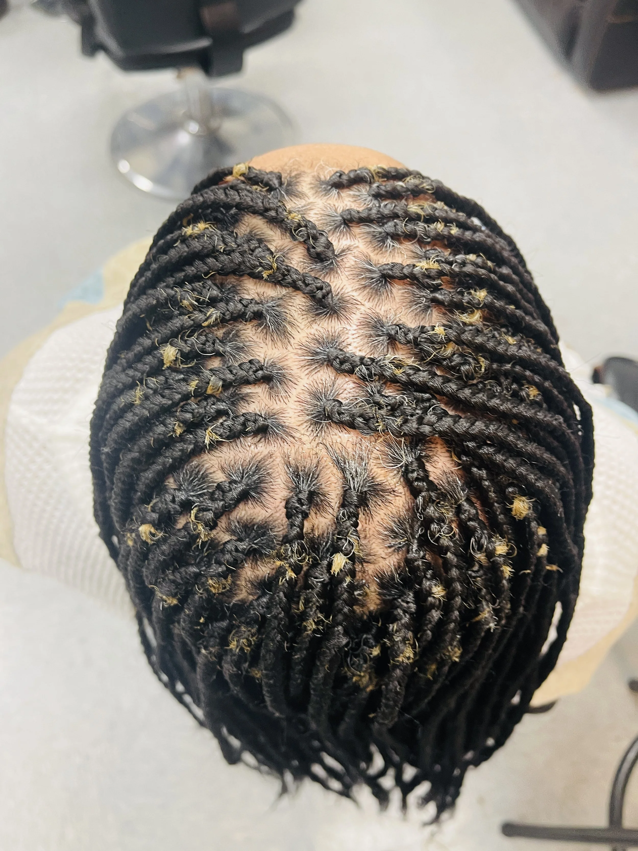 Top view of a person's head with dreadlocks adorned with yellow thread and some yellow hair accessories, with a chair and a sterile clinical environment in the background.