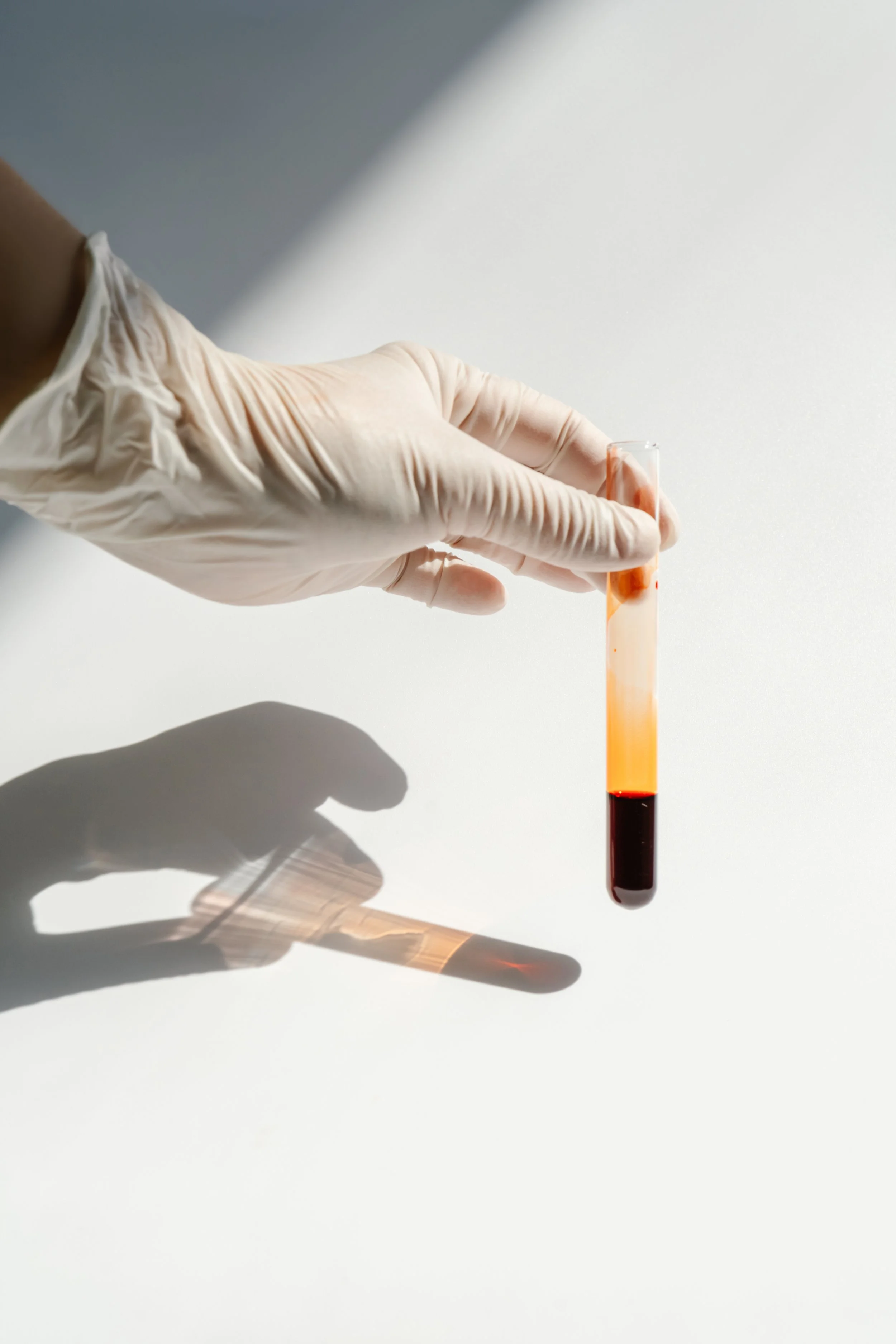 PRP Facial Rejuvenation Therapy
