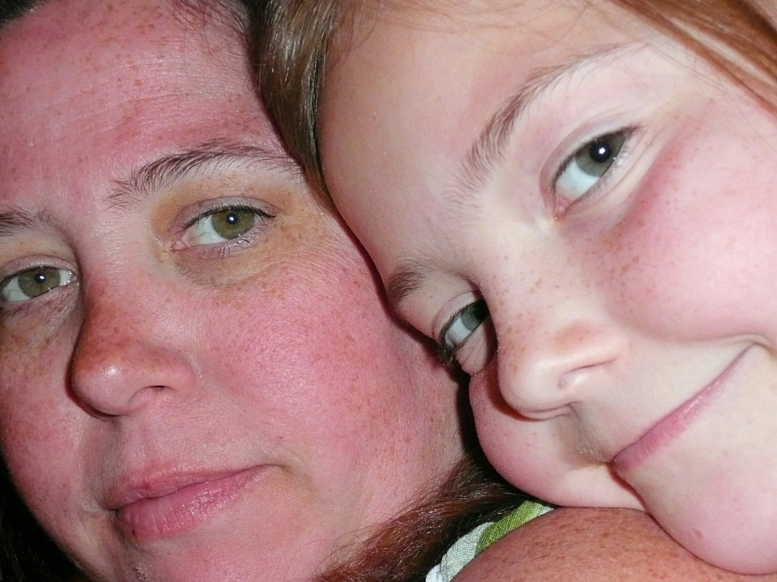 A close-up image of faces with one person resting their cheek on the other person's face. Both individuals have light skin, with one having slightly red cheeks and the other having freckles and slightly pink cheeks. Their eyes are visible, and they appear to be in a friendly, close pose.