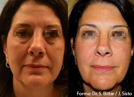 forma-before-after-dr-s-bittar-dr-j-sisto-preview-1.jpg