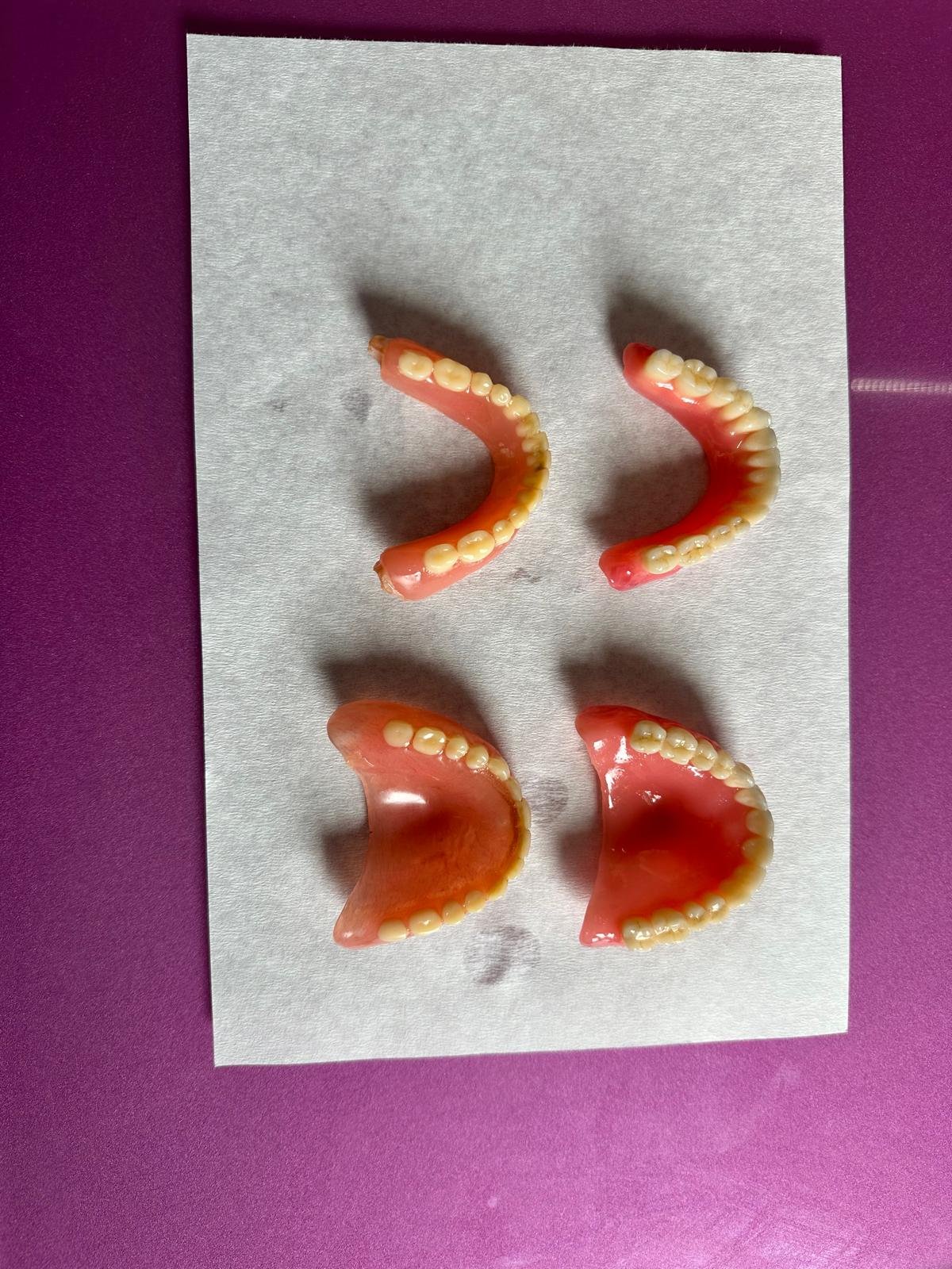 Standard Replacement Denture Arch