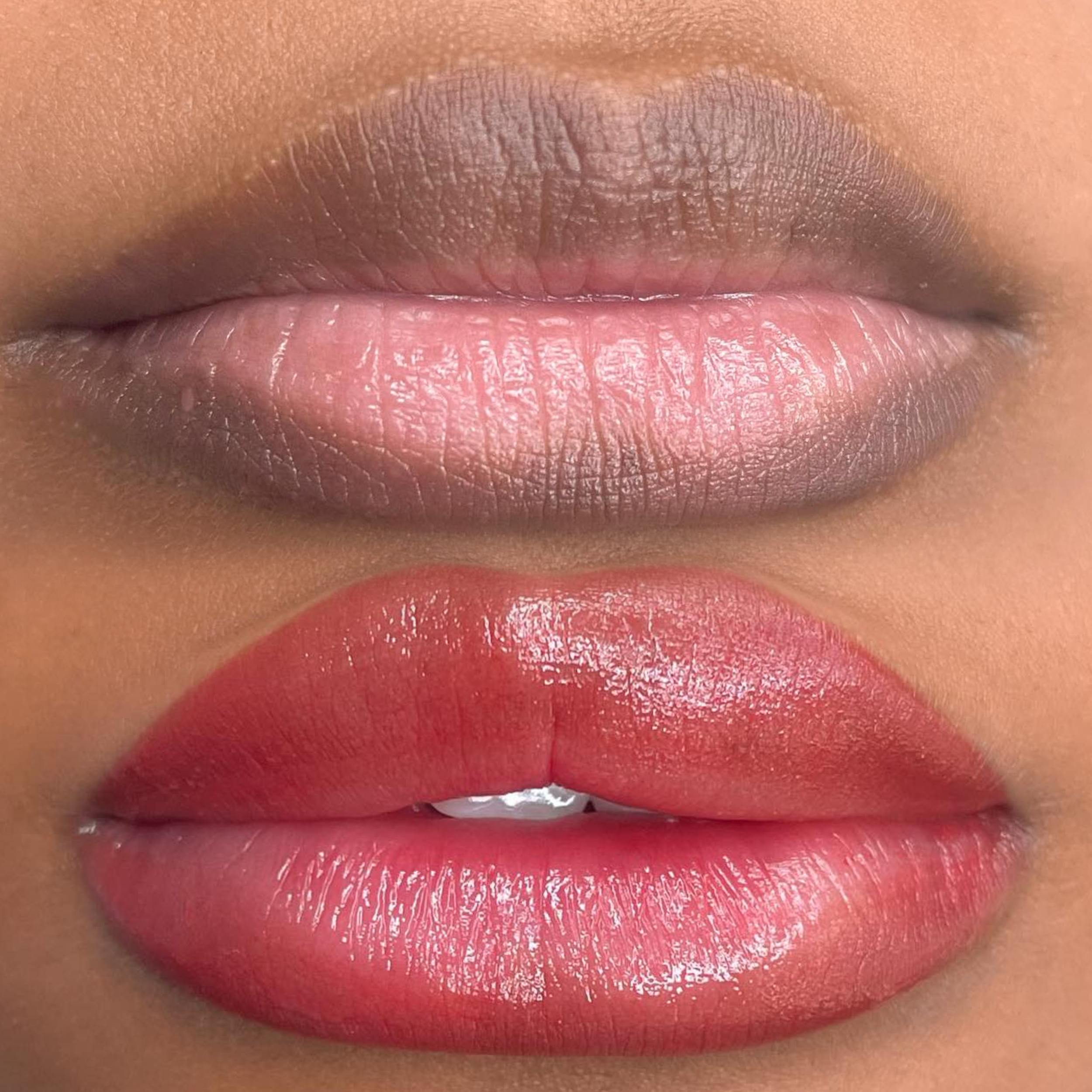 Lip Neutralization