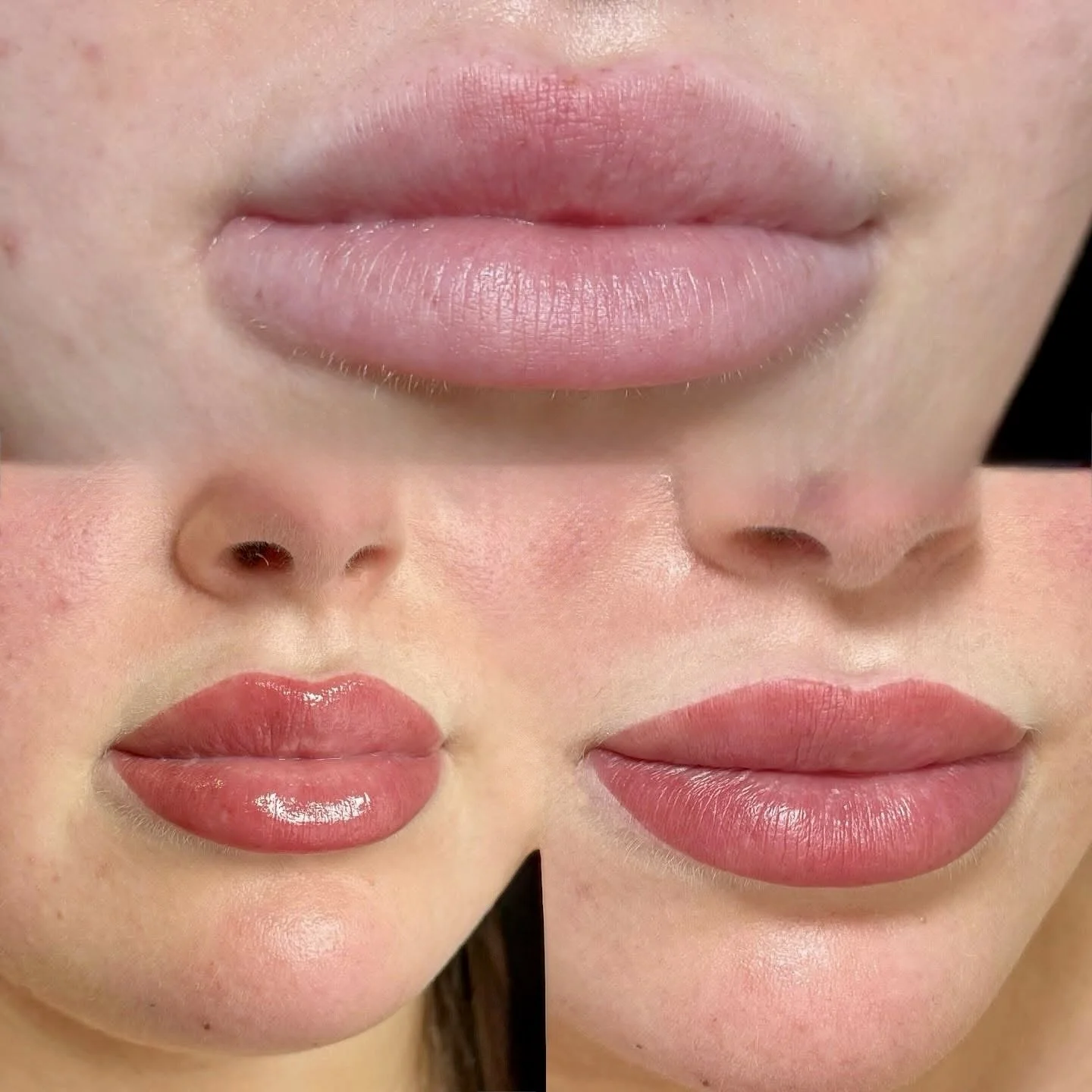 Lip blush before and after showing soft color enhancement, improved lip tone, and a smooth natural healed finish