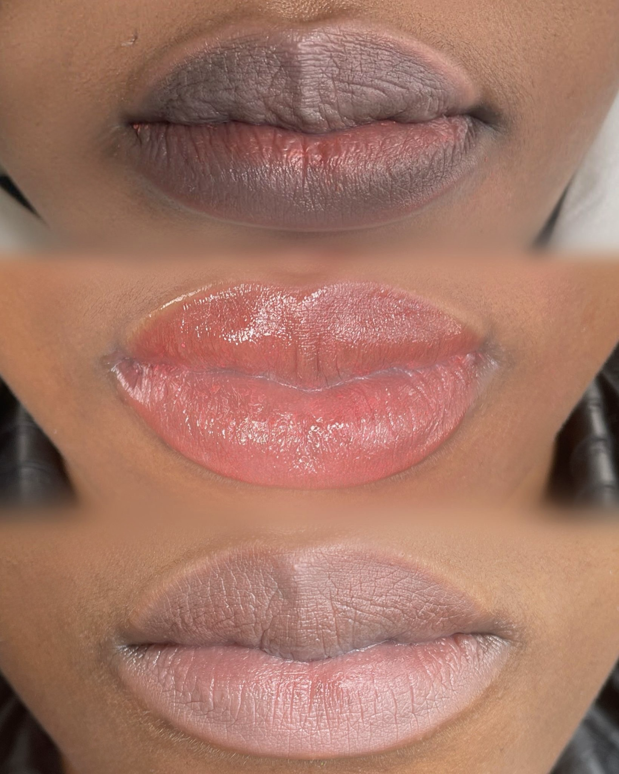 Lip Neutralization