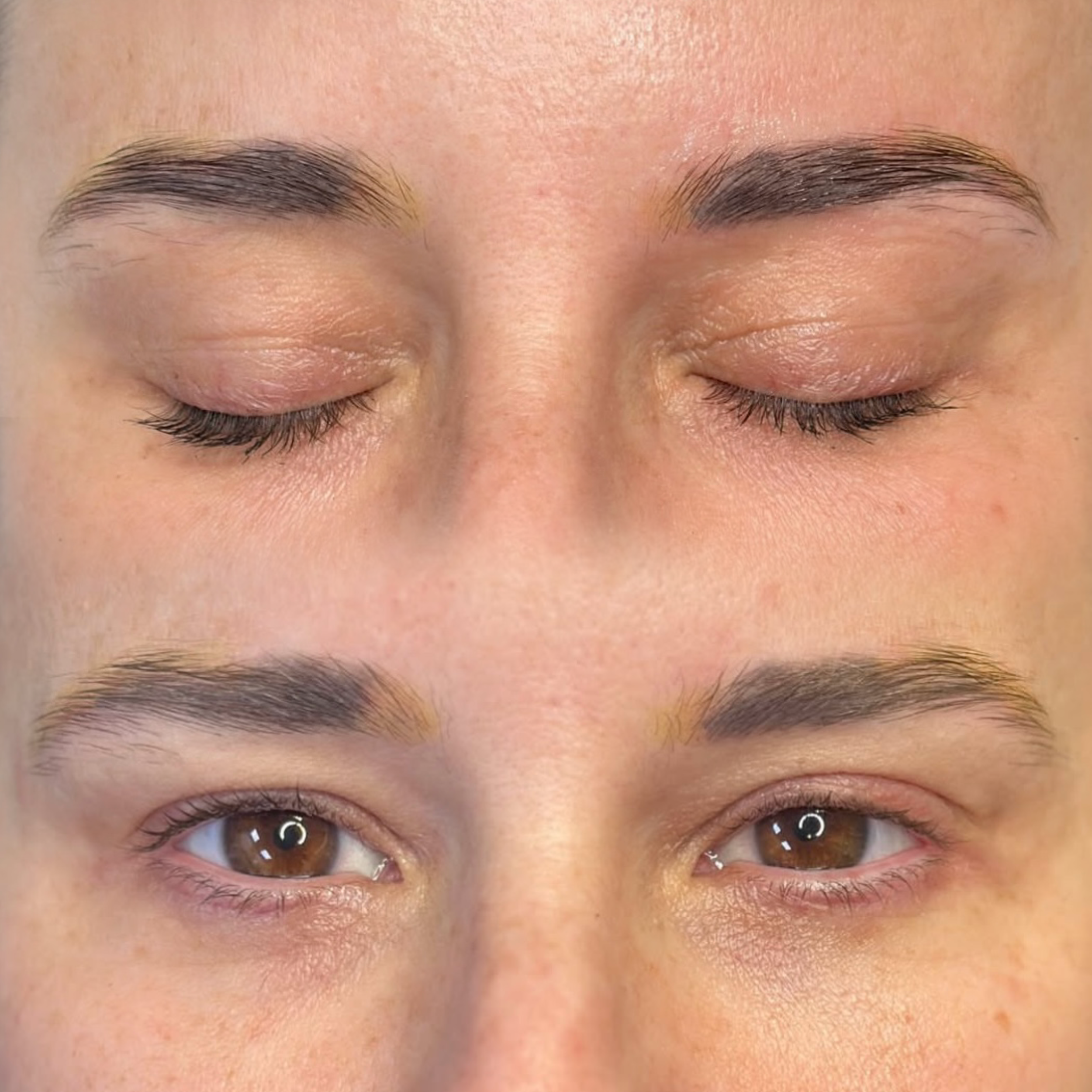 Pigment Removal (per session)