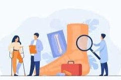 Deciding on Ankle Surgery: What Finally Pushed Me Forward After Months of Pain and Instability