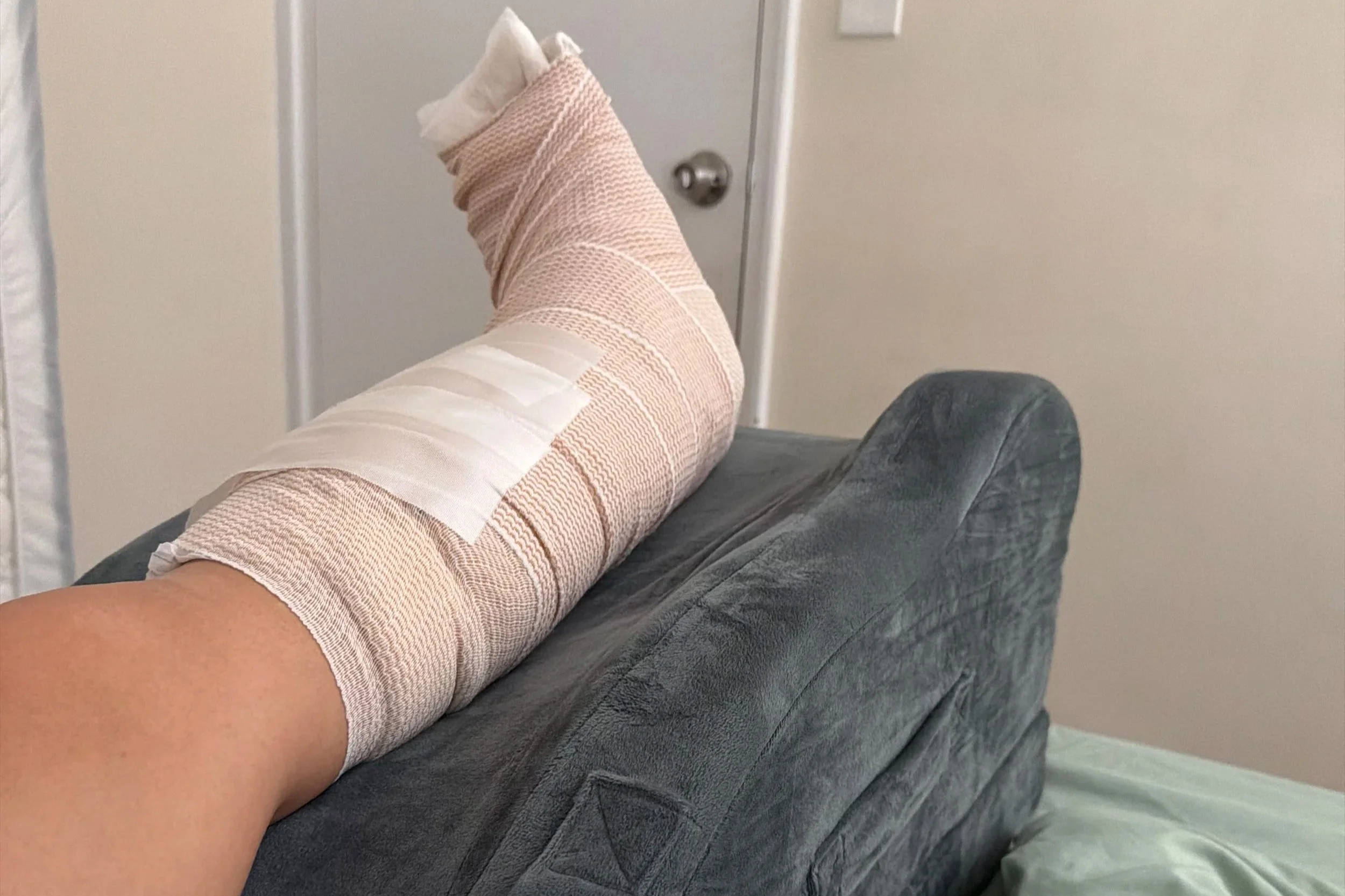 The Daily Challenges of Recovery: Day 6 Post Op