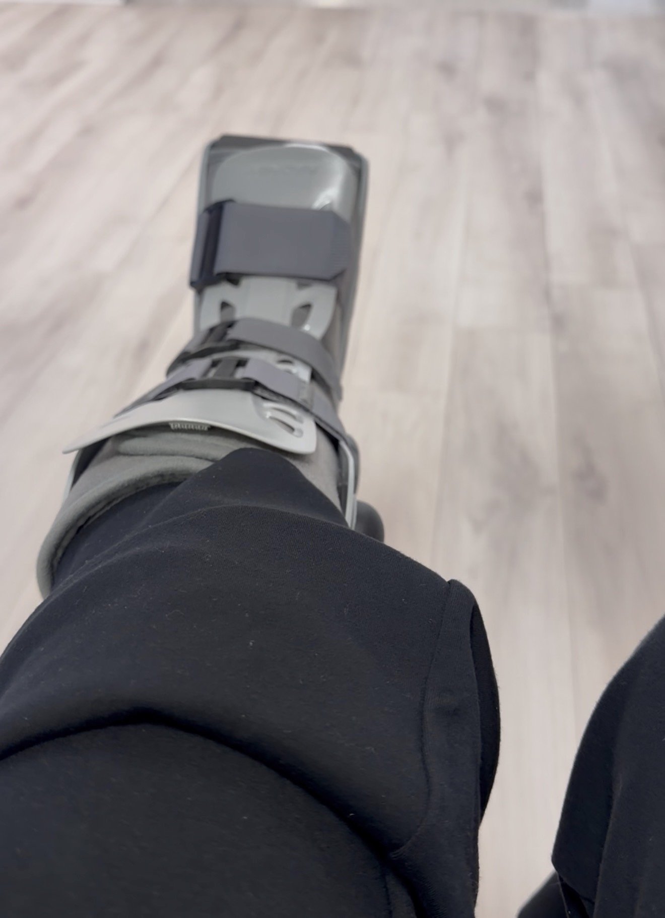 Day 13 Post Op: Cast Off, Sutures Off, and Moving Into CAM Boot