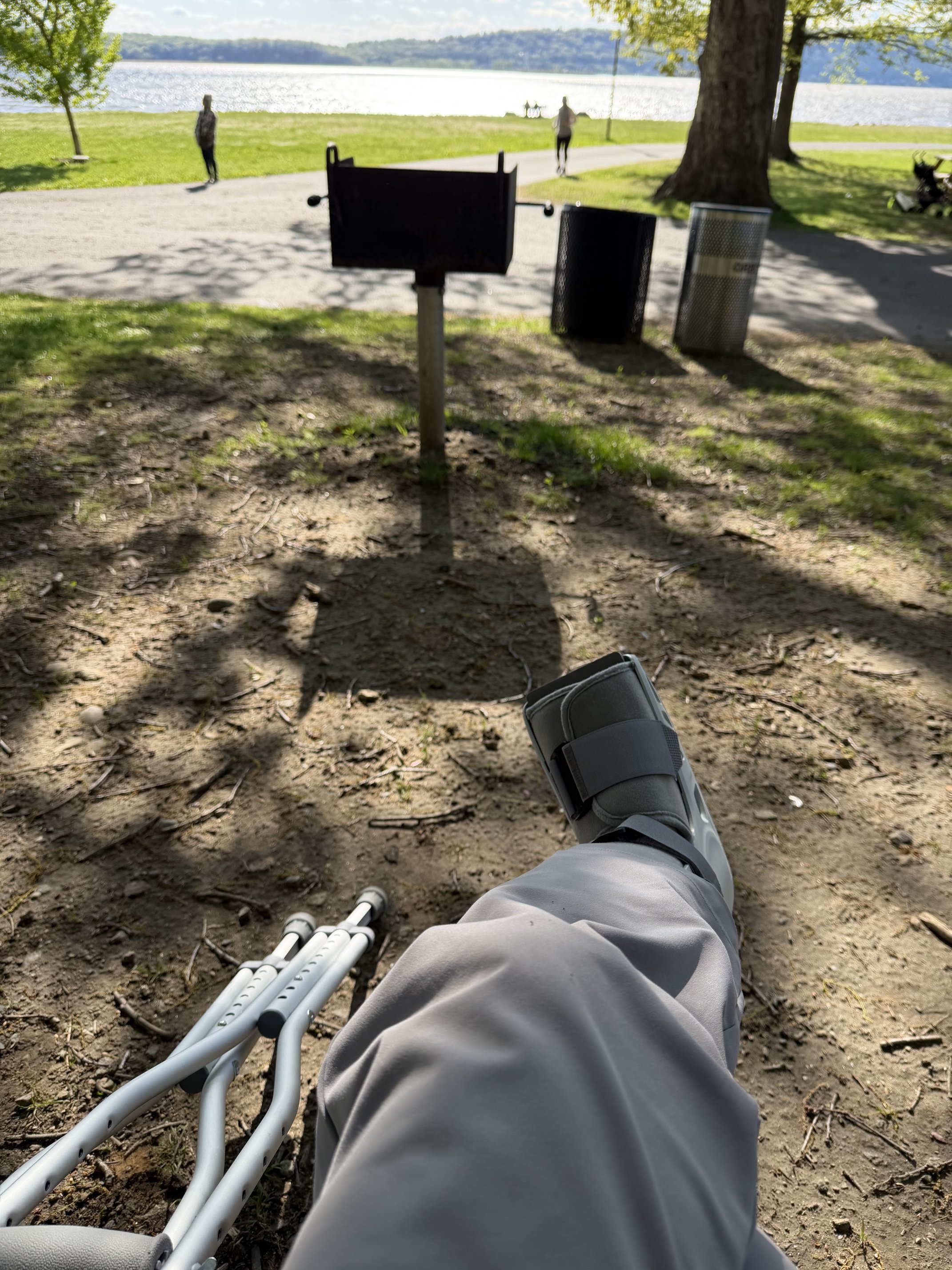 Day 21 Post Op: The Week I Fell Twice