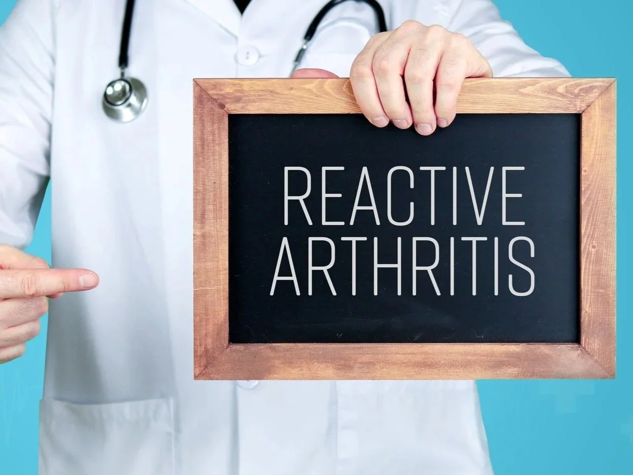 Reactive Arthritis