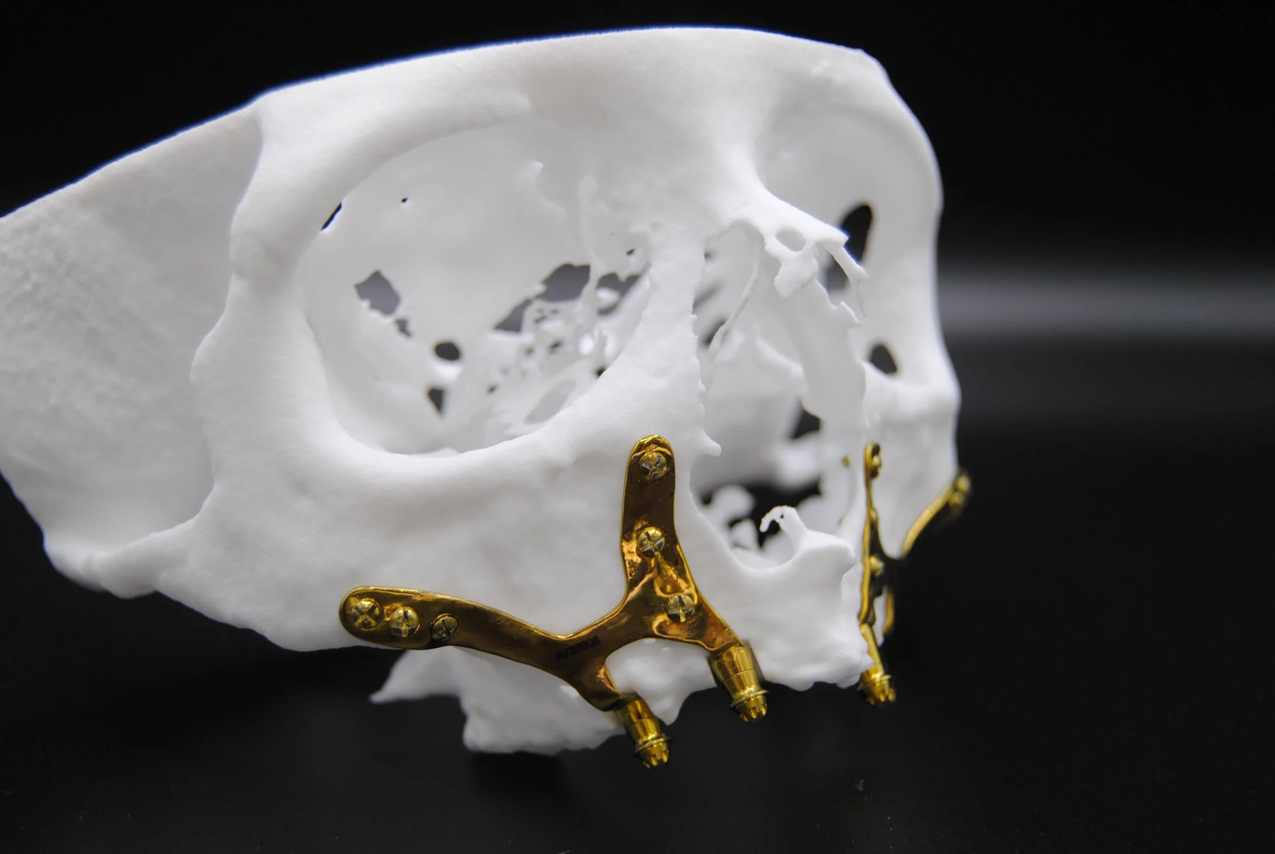 A decorative white skull adorned with gold jewelry, set against a black background.