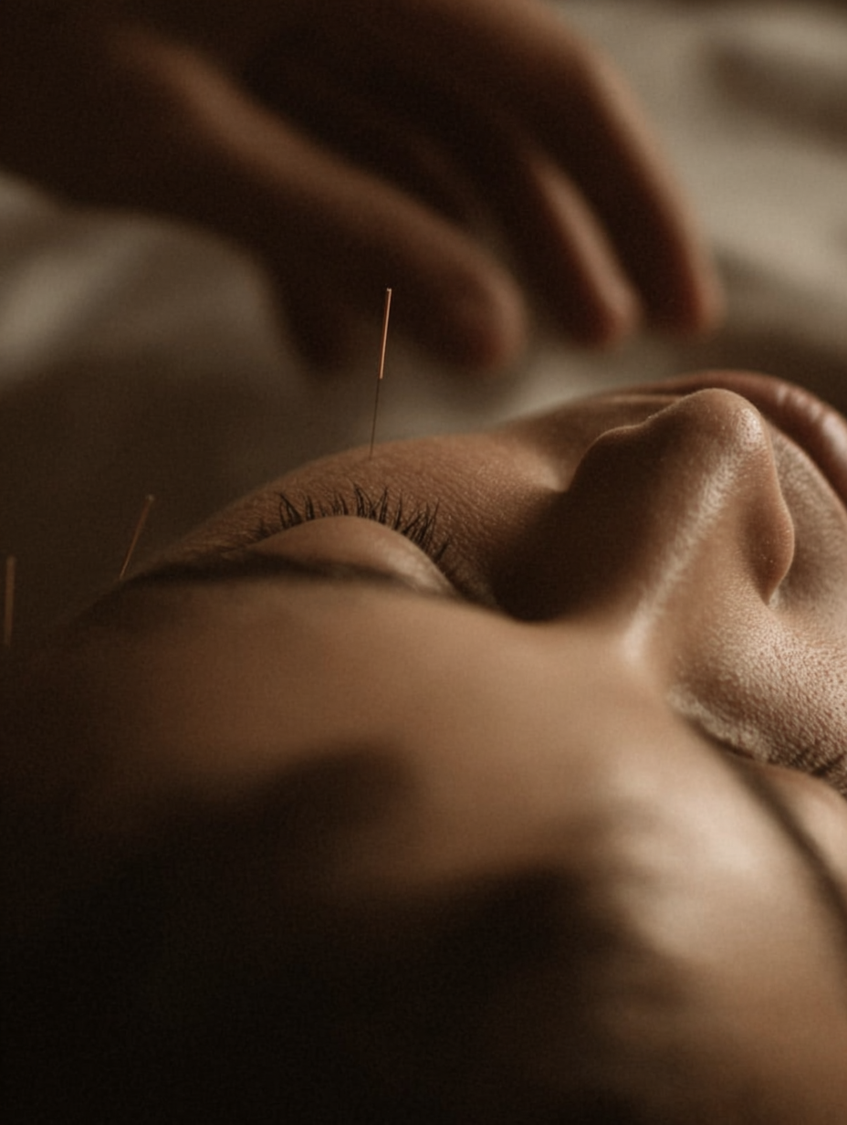 Close-up of a person receiving acupuncture treatment, with needles inserted in their face and neck while they lie down with eyes closed.