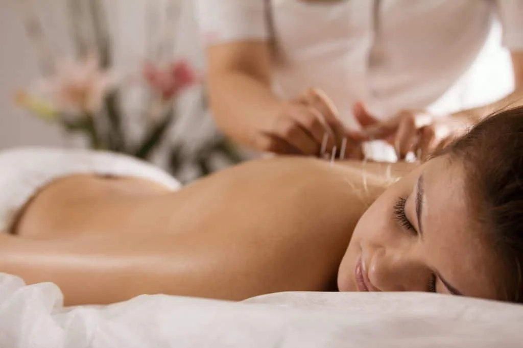 Acupuncture in Los Angeles & Beverly Hills