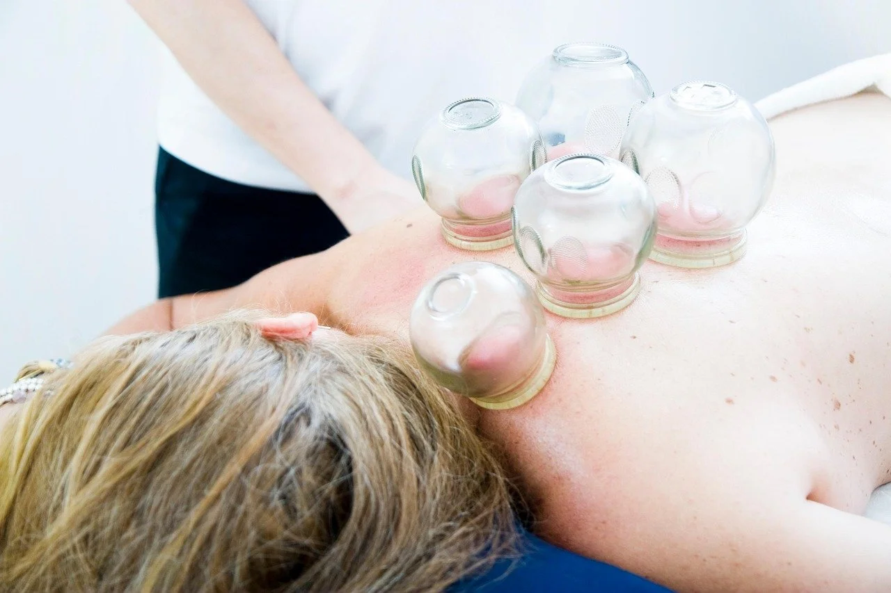 Cupping for pain relief