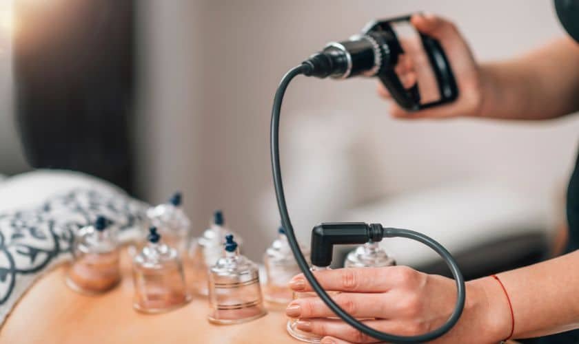 Do You Need Cupping Therapy?