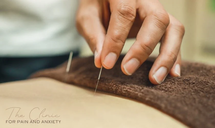 How To Choose The Right Acupuncture Clinic