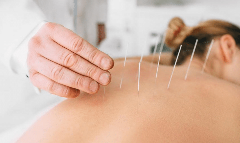 5 Reasons to Try Acupuncture For Stress and Anxiety Relief