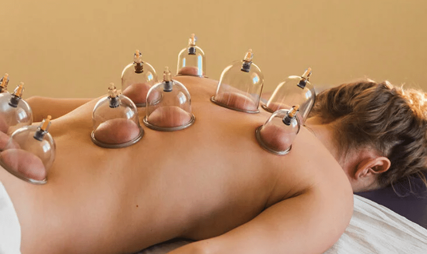 What is Cupping Therapy and How Does it Work?