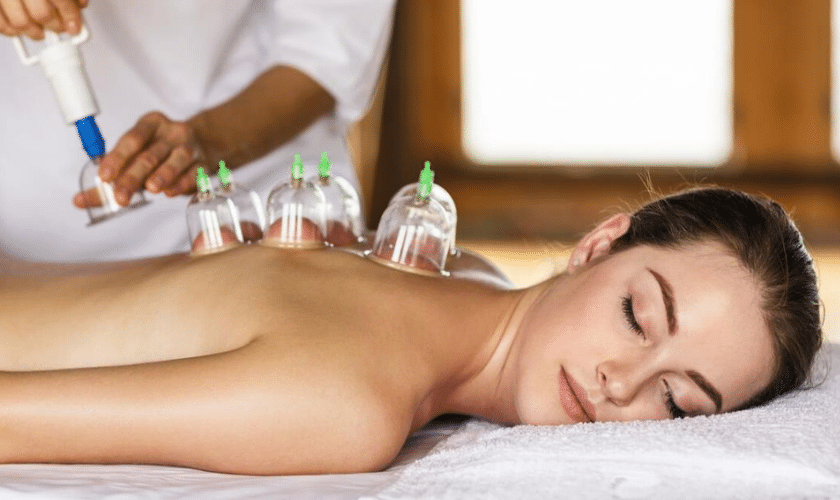 How Cupping Therapy Can Help with Pain Management