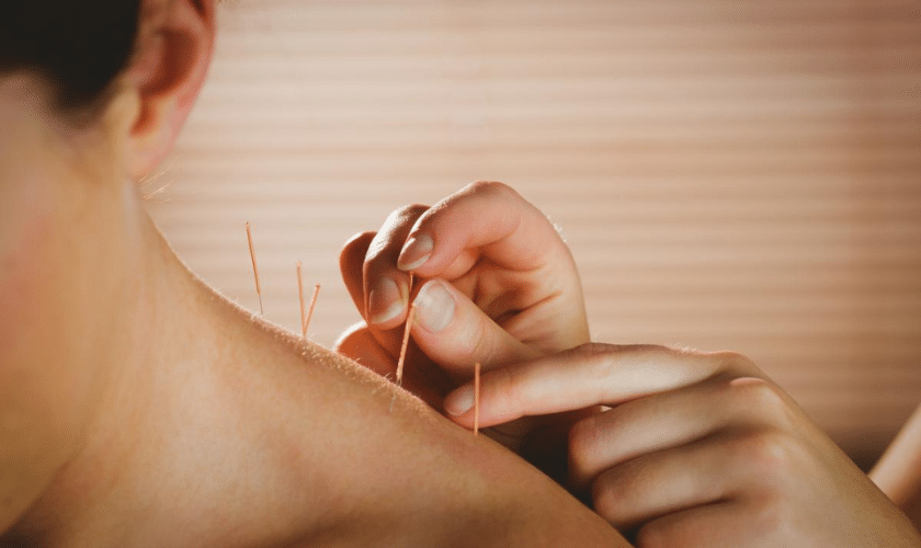 Surprising Benefits of Acupuncture You Never Knew About