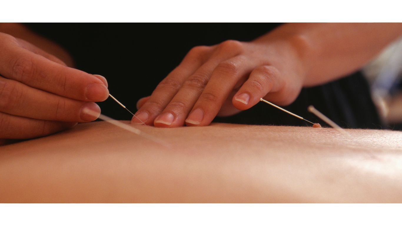 Satisfied client testimonial for acupuncture treatment in Beverly Hills