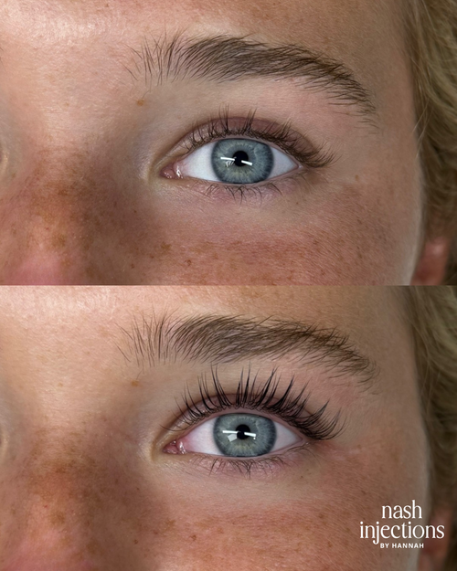 Advanced esthetics before and after result