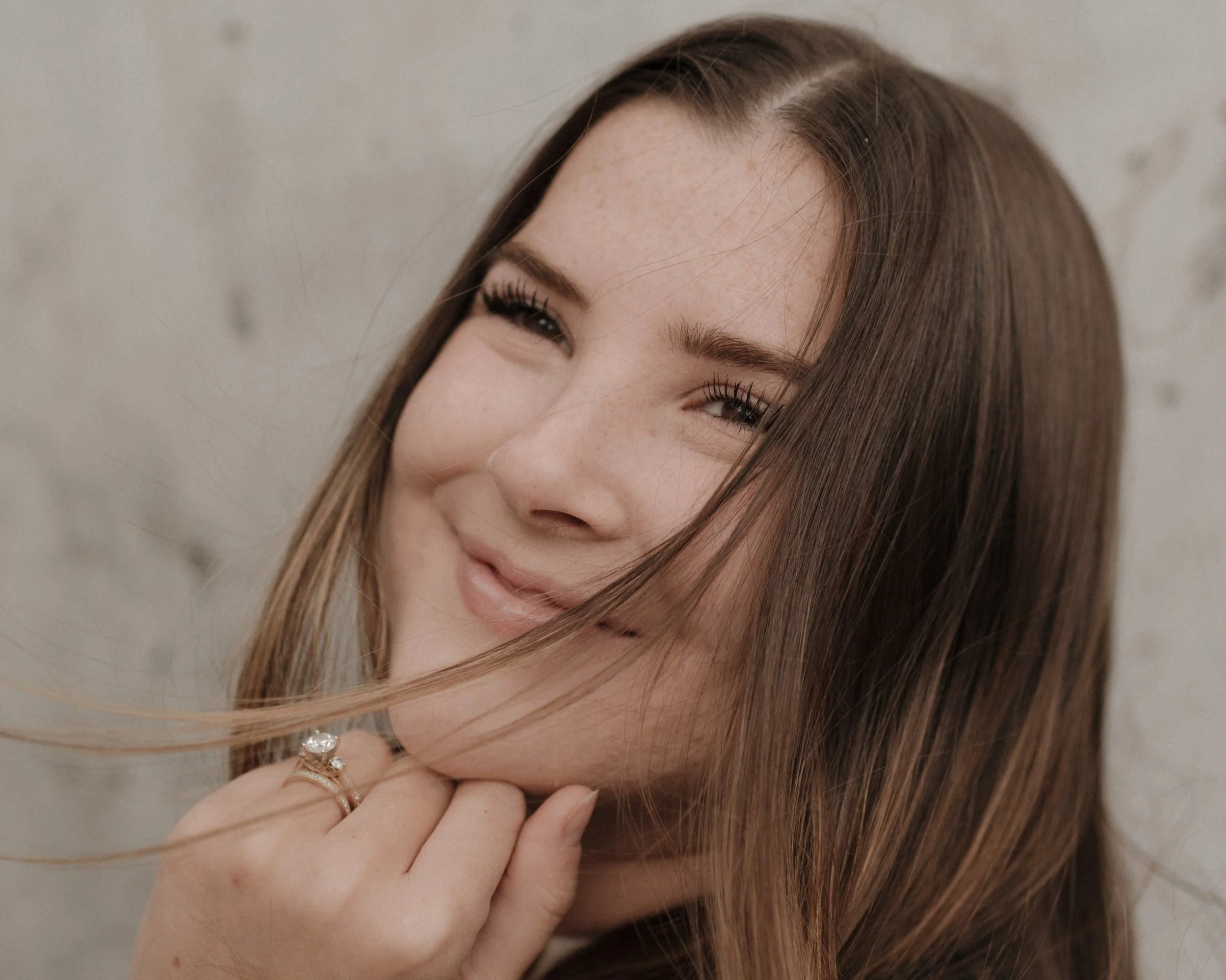 Supercharge Your Skin Health: What is Microneedling?