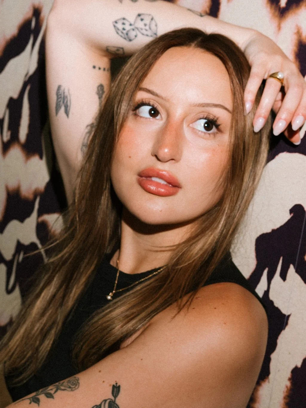 What is Facial Balancing with Dermal Fillers?