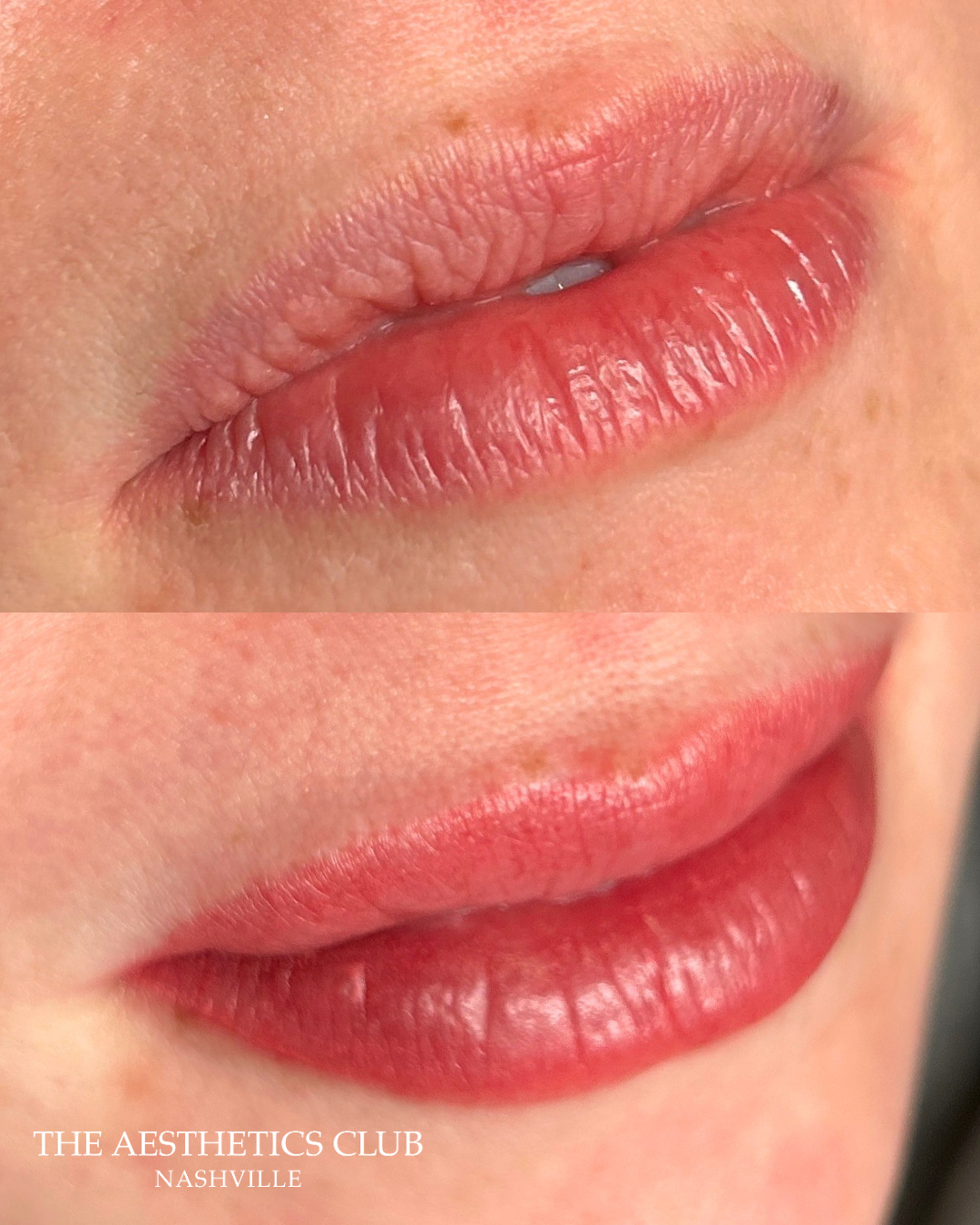 before and after lip blushing in nashville