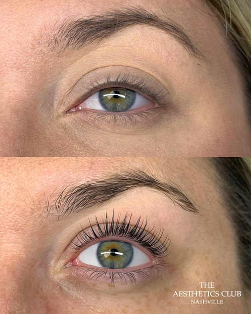 Before and after Korean lash lift