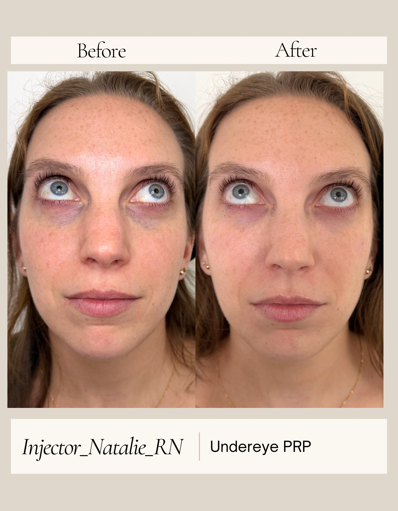 Instagram Before and After - 1 (1).PNG