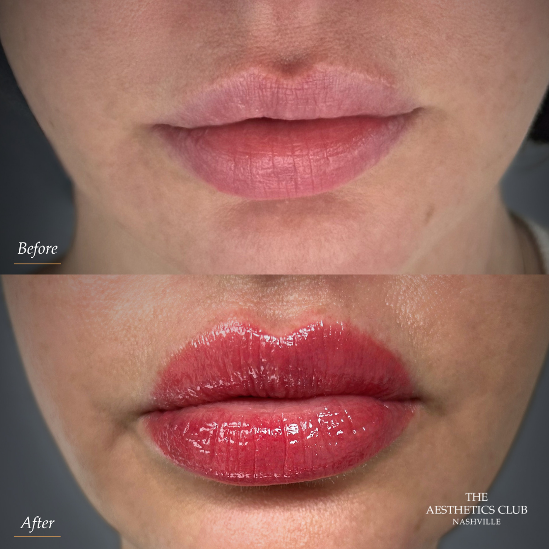 Lip Blushing before and after by Cailyn Gallagher