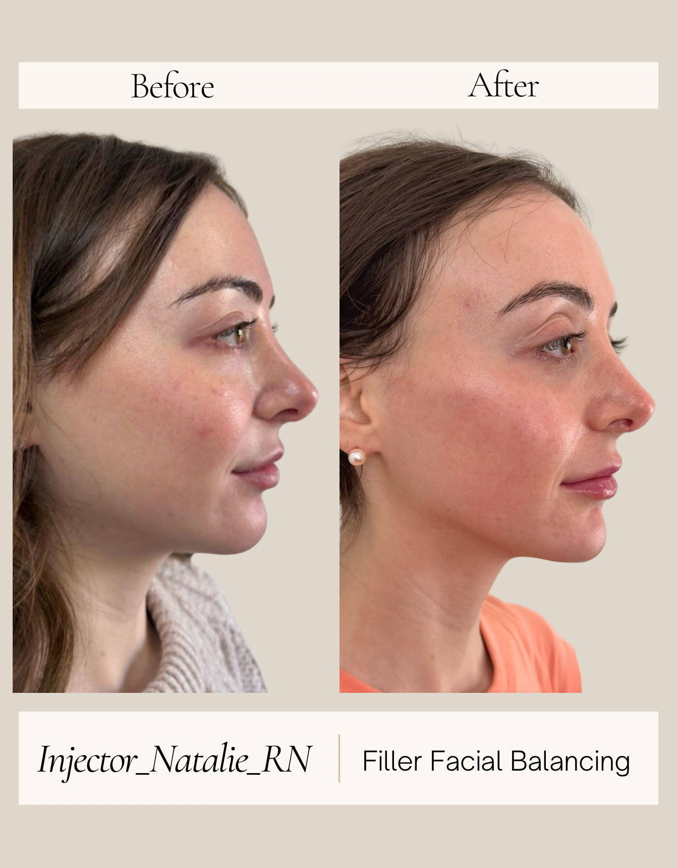 Instagram Before and After - 2.PNG
