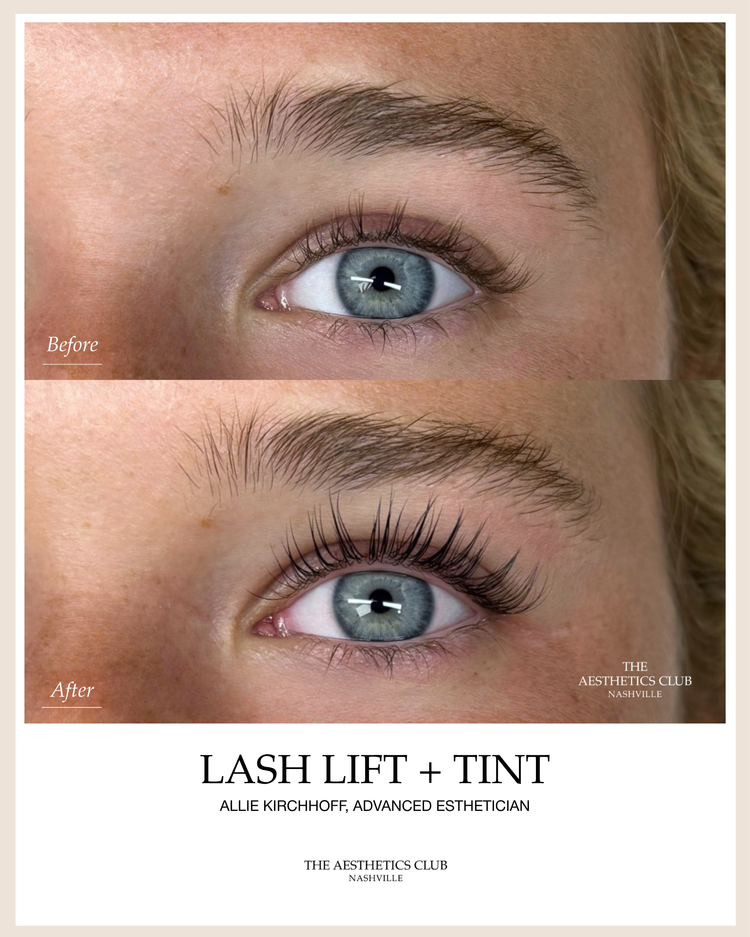Before and after Lash Lift in Nashville by Allie Kirchhoff