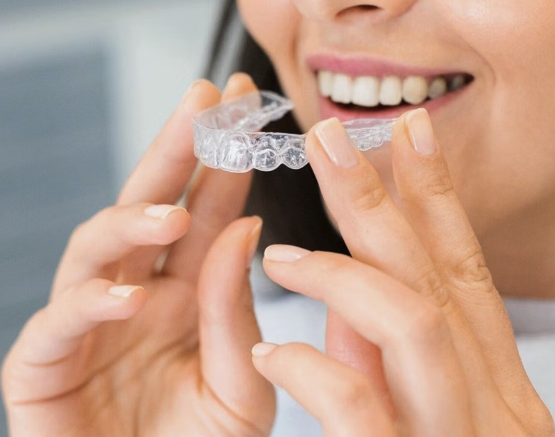 Retention is a patient journey to support them with retainer care, replacement and any other needs.
