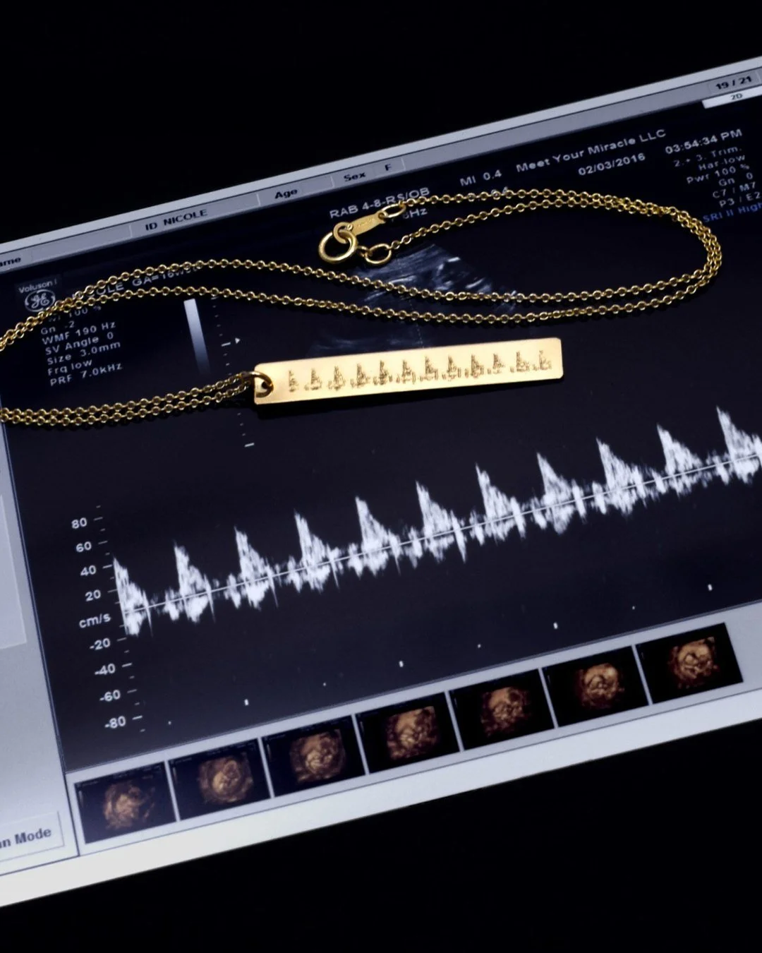 Ultrasound heartbeat waveform shown alongside personalized heartbeat jewelry created from baby’s actual heartbeat.