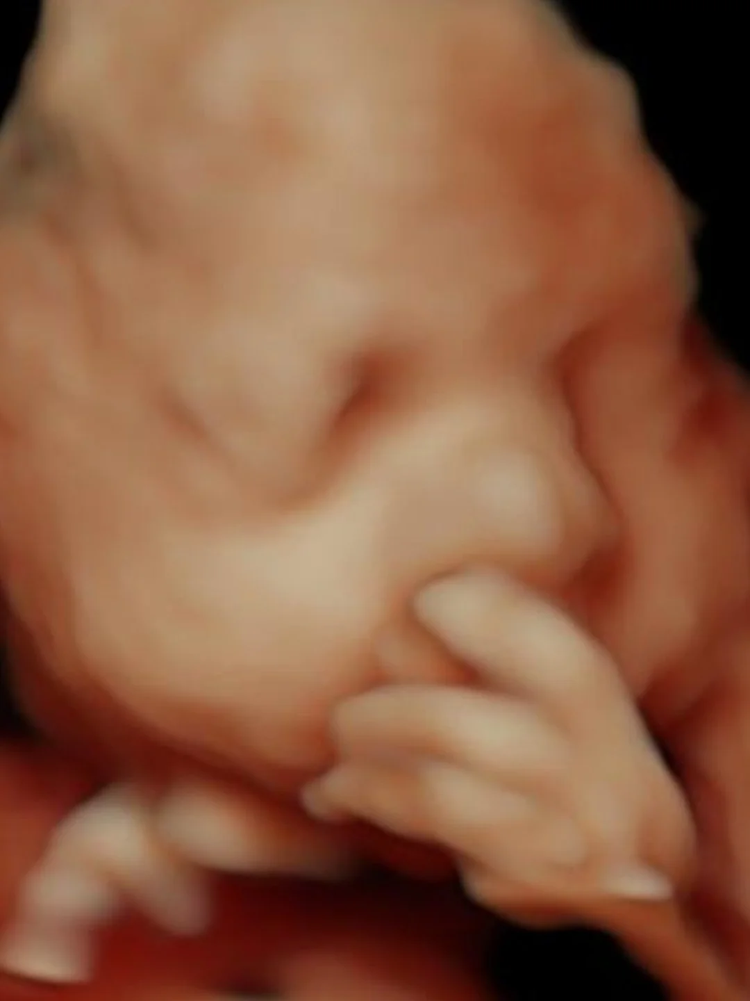 HD ultrasound image showing baby sucking their thumb.