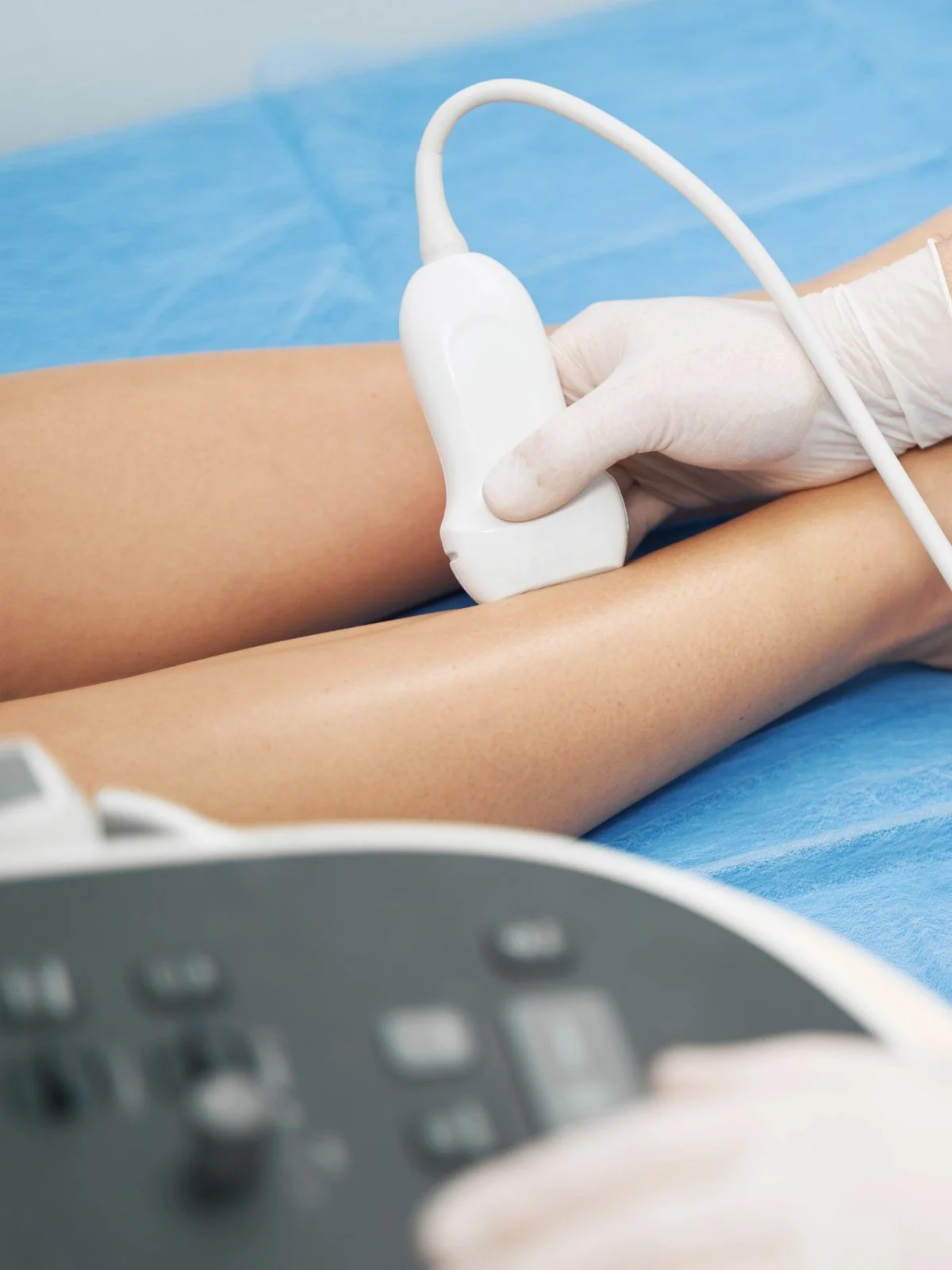 Vascular ultrasound examination for arteries, veins, and blood flow evaluation.