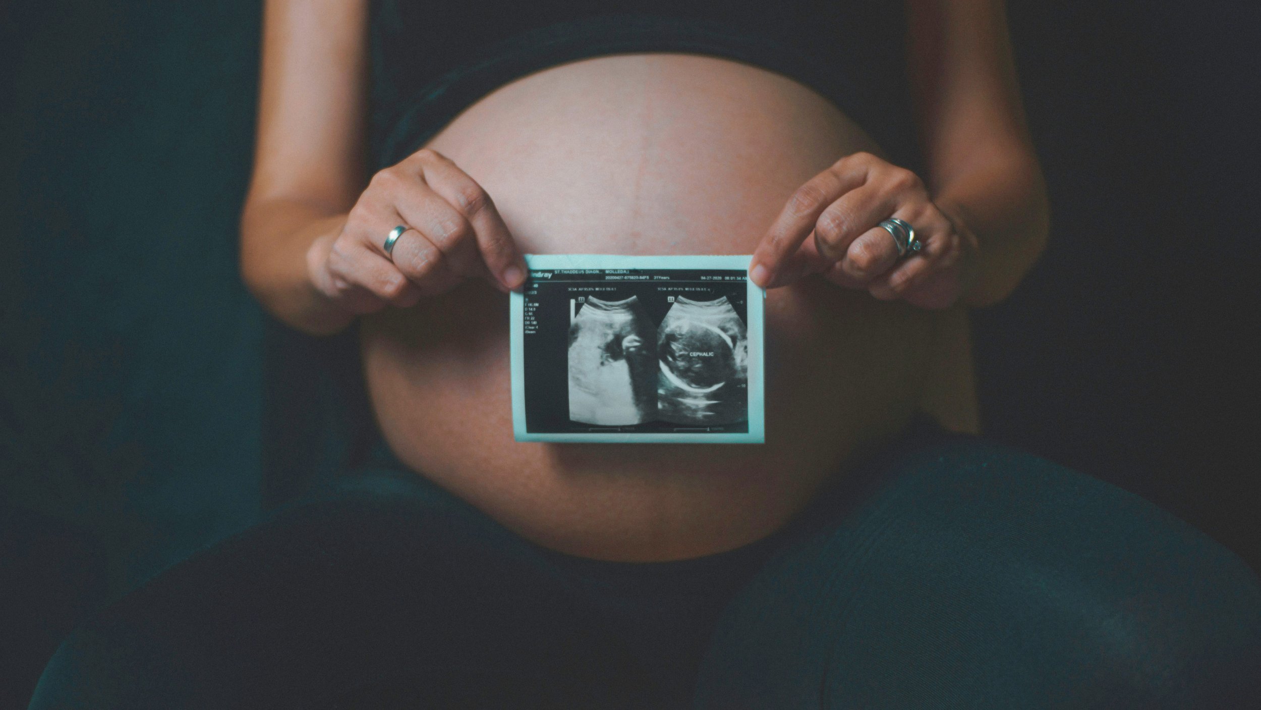 A pregnant person holds an ultrasound scan in front of their bare baby bump, wearing rings on both hands, against a dark background.