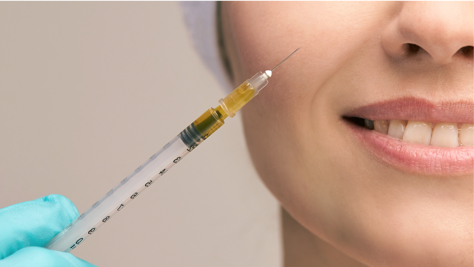 Close-up of a person smiling slightly while receiving a facial injection from a medical professional wearing blue gloves. The syringe contains a yellowish substance, and the person's face is partially visible showing pink lips and teeth.