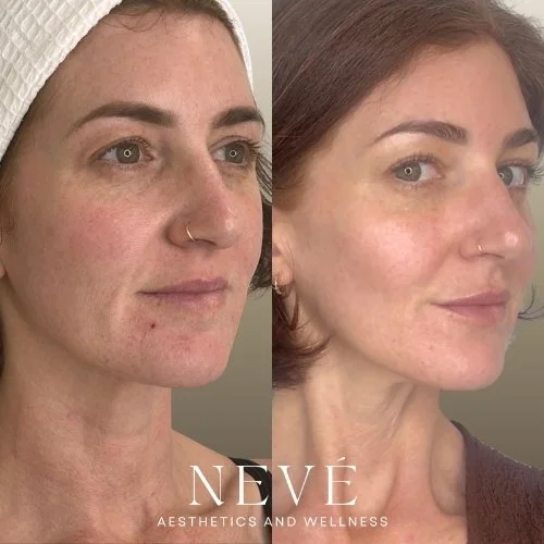 Texture and Skin Quality
