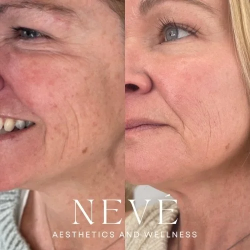 Pigment, Tone, and Sun Damage