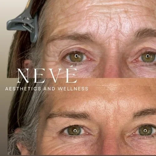 RF Total Skin Solution