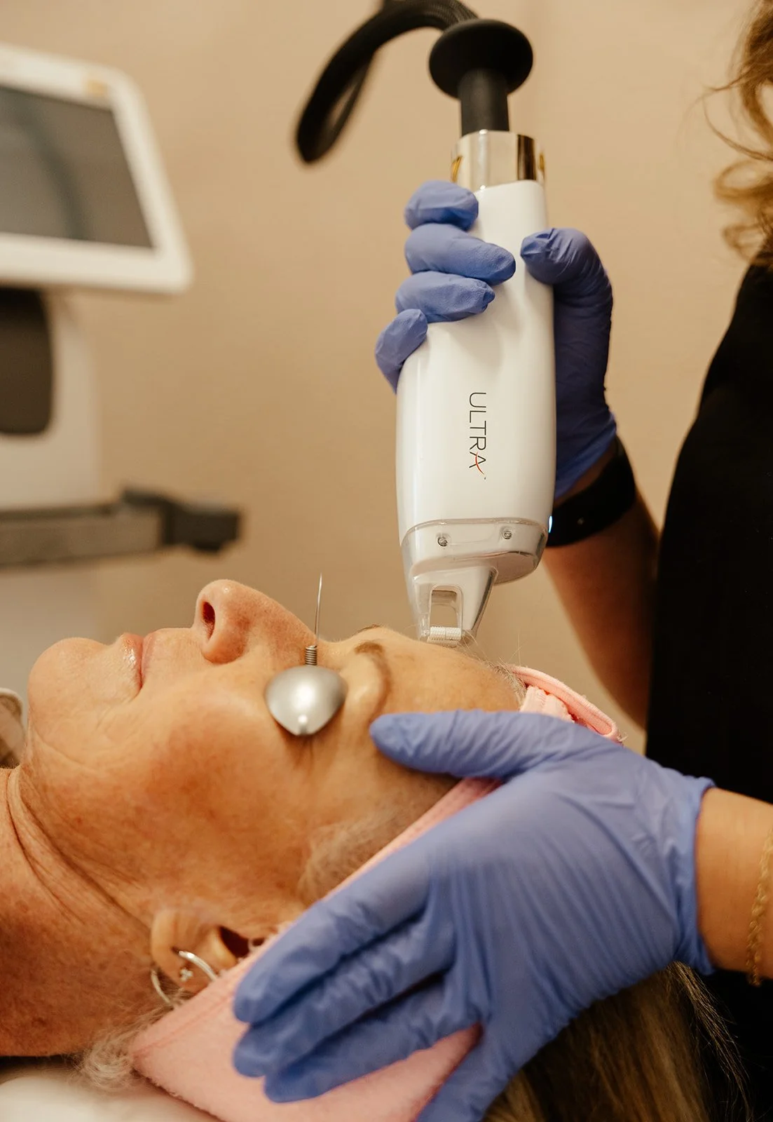 Lutronic Ultra™ Laser Treatment