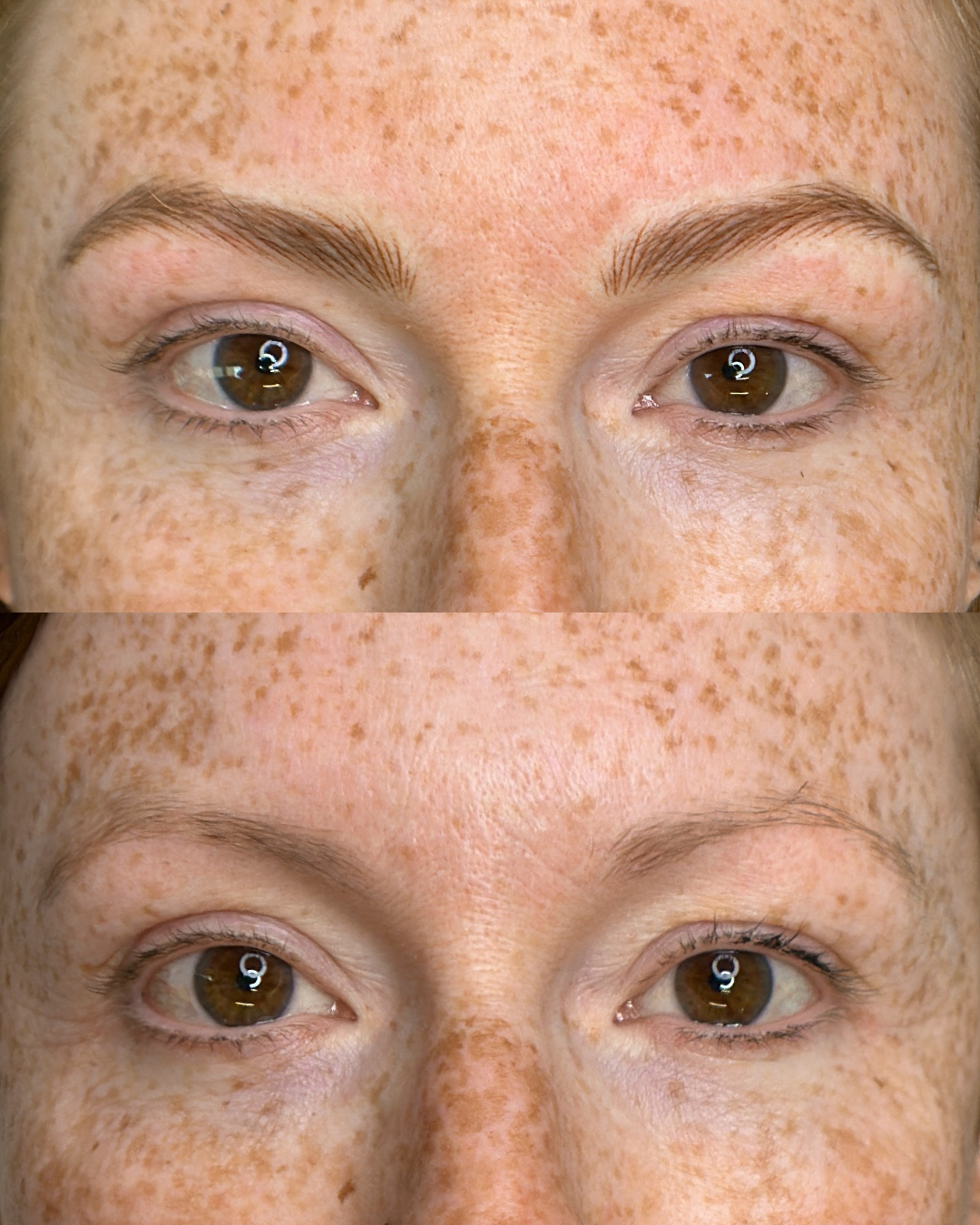 Before and After Machine Nano Brows by Kellee