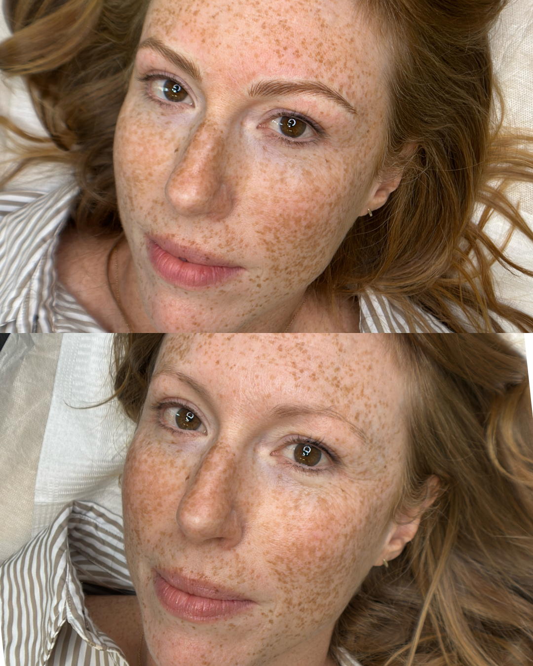 Before and After Machine Nano Brows y Kellee