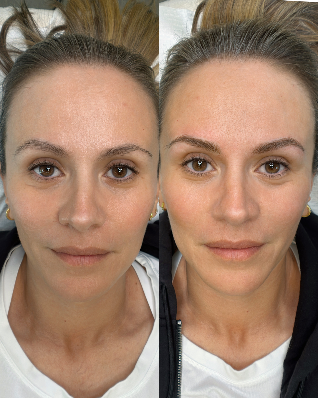 Before and After Machine Nano Brows by Kellee