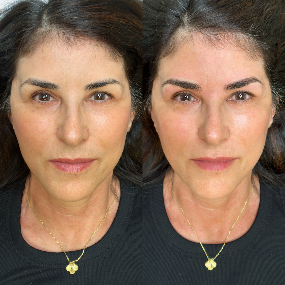 Before and After Machine Nano Brows by Kellee